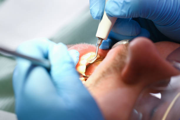 Best Emergency Broken Tooth Repair in Yorkville, WI